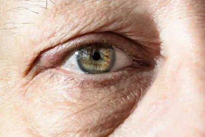 Врач-офтальмолог рассказал о популярных мифах, связанных с лечением глаз –  Москва 24, 12.09.2023