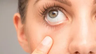 Рефракция глаза: описание, функции, заболевания и лечение