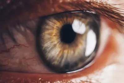 Учеба по офтальмологии 2022 Синдром красного глаза