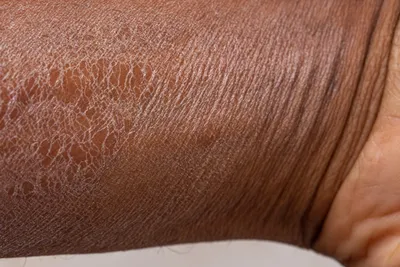 Лечение заболеваний кожи | Клиника красоты Амазонка