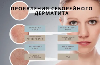 Лечение грибка кожи головы – Публикации – Лаборатория Ан-Тек
