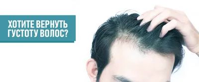 Белый налет на коже головы и волосах - Real Trans Hair - клиника пересадки  волос и биологического омоложения