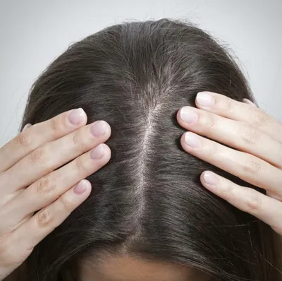 Заболевания кожи и волосистой части головы (Микроспория) | Горноуральская  районная поликлиника | Версия для слабовидящих