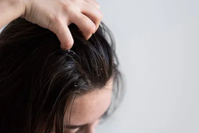 Распаривание кожи головы: процедура, которая заменит пилинг и при этом  увлажнит волосы