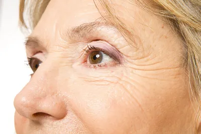 Покраснение глаз — может быть симптомом COVID-19, но нечасто | Клиника  Рассвет