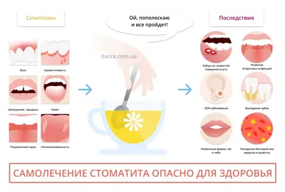 Профилактика стоматологических заболеваний - УЗ \"15-я городская поликлиника\"