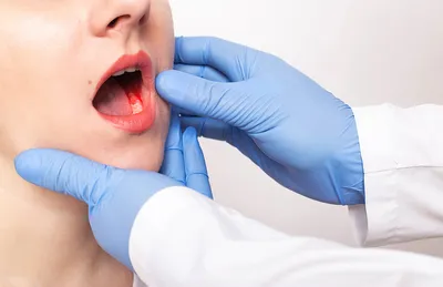 Какие заболевания вызывают сухость во рту?