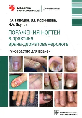 Пин от пользователя Lis на доске болезни ногтей и кожи | Ногти