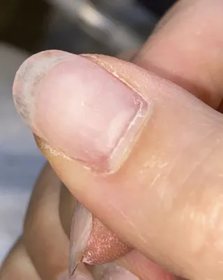 Грязные длинные ногти имеют семенозачатки сделать больной Грязь под ногтями  ребенка Руки детей гигиены Стоковое Изображение - изображение насчитывающей  деформировано, грибок: 151641731