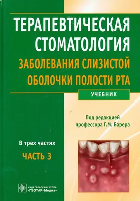 Лечение воспаления слизистой оболочки полости рта в Москве - Цены на  Лечение воспаления слизистой оболочки полости рта в стоматологии
