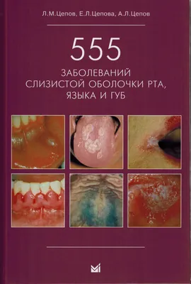 Книга: Терапевтическая стоматология. Заболевания. Автор: Барер Гарри  Михайлович, Волков Евгений Алексеевич, Гемонов Владимир Влади