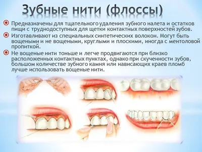 Лечение слизистой оболочки полости рта в Санкт-Петербурге: цены в клинике  ДОКТОР ДЕНТ