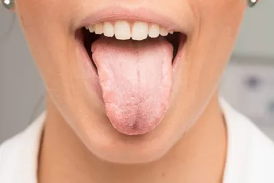Лечение заболеваний полости рта в Москве — цены в клинике «Зубная Формула»