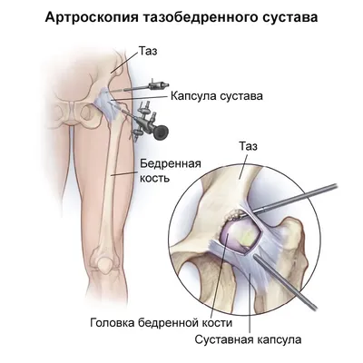 Замена тазобедренного сустава в Польше | Цена ▷ ТОП-10+ клиник 2024