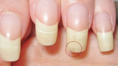 Запечатывание ногтей воском. Как укрепить ногти. - YouTube