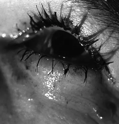 A teardrop on the face, опухшие …» — создано в Шедевруме