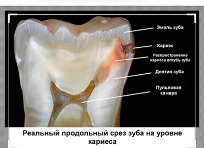 А какие у тебя оправдания, гнилозубик? :) | Пикабу