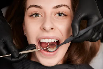 Дальнейший план лечения зубов - Терапия - Форум стоматологов  (стомотологический форум) - Профессиональный стоматологический портал  (сайт) «Клуб стоматологов»