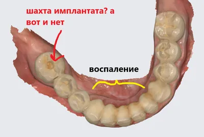 Делать зубы страшно? | Пикабу