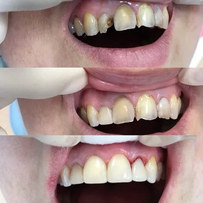 Лечение зубов без боли в стоматологической клинике | Стоматология Багита