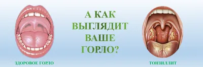 Как лечить больное горло у ребенка 2 лет: советы и рекомендации