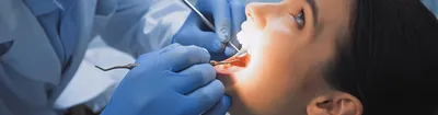 Проявления в полости рта СПИДа - БУ \"Нефтеюганская городская  стоматологическая поликлиника\"
