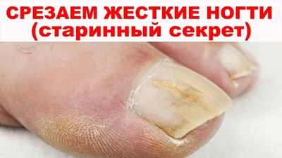 DiKa.me - 𑁍 Да, я люблю непокрытые ногти на ногах 😍 Люблю здоровые  красивые ухоженные ногти, и они не могут смотреться некрасиво. То, что  создала природа поистине красиво. Вы согласны? ⠀