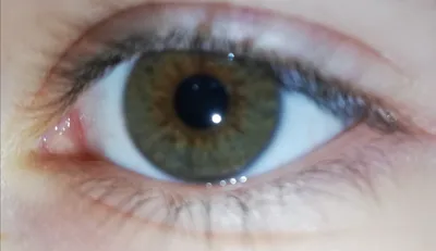 Ответы Mail.ru: Какой у меня цвет глаз?