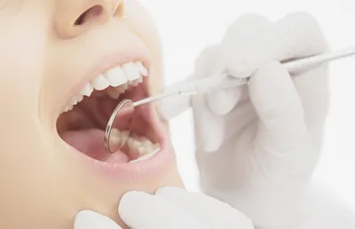 Dentalpik Скребок для чистки языка щетка для языка 1 шт зеленый