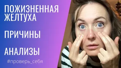 желтые белки глаза｜Búsqueda de TikTok