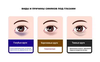 Маска для кожи вокруг глаз Shiseido Pure Retinol Instant Treatment Eye Mask  моментального действия для контура на основе чистого ретинола - «Устали  таскать синие мешки??? Потаскайте желтые тряпочки!!!!+фото» | отзывы