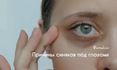 Тёмные круги под глазами: как убрать консилером правильно | Beauty Insider