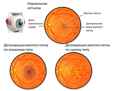 Темные круги под глазами — как избавиться: причины, как быстро убрать круги  вокруг глаз