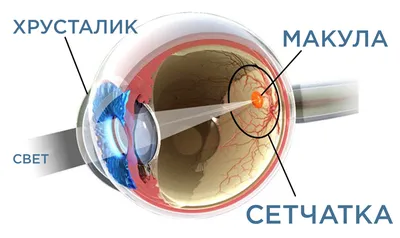 Ксантелазма: причины, симптомы и лечение