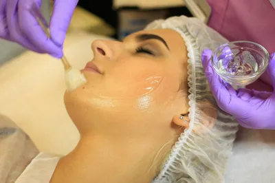 Химический пилинг кожи лица и тела: что это такое, виды пилинга | Beauty  Insider
