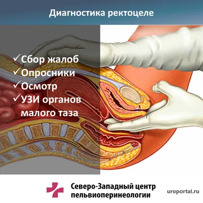 Киста половой губы: причины, симптомы, диагностика, лечение, операция в  клинике «АльтраВита»