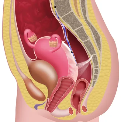 Опущение и выпадение матки: симптомы, причины, диагностика.
