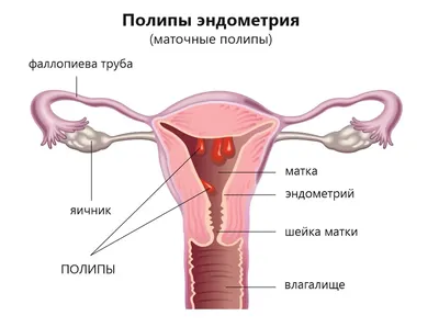 Киста яичника лечение в Киеве: цена на лечение кисты яичников, записаться в  клинику Оксфорд Медикал