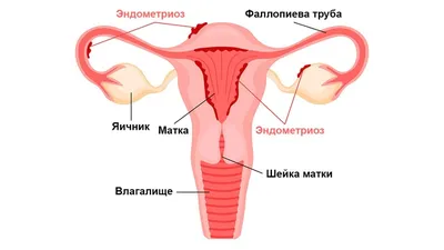 Стесняюсь спросить. Все, что вам нужно знать о «женских» болезнях (мужчинам  тоже!) - CityDog.io