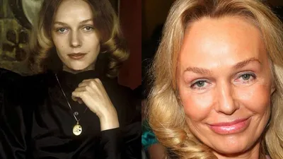 Жертвы ботокса: российские знаменитости в погоне за красотой! | PROFFLESSON  | Дзен