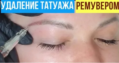 Жертвы татуажа фото фото