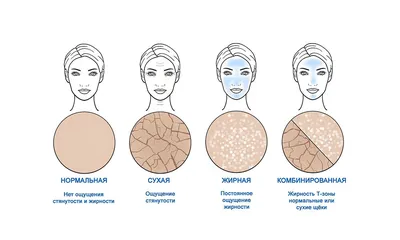 Жирная кожа на лице: лечение, уход, причины кожного себума и косметические  процедуры, как избавиться