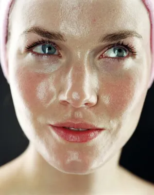 Жирная кожа лица: причины и как правильно ухаживать | Сеть клиник ЛИНЛАЙН