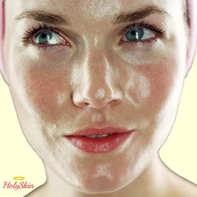 Процедура для проблемной кожи лица – косметолог Татьяна Гордиенко