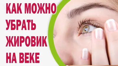 Милиум - признаки, причины, симптомы, лечение и профилактика - iDoctor.kz