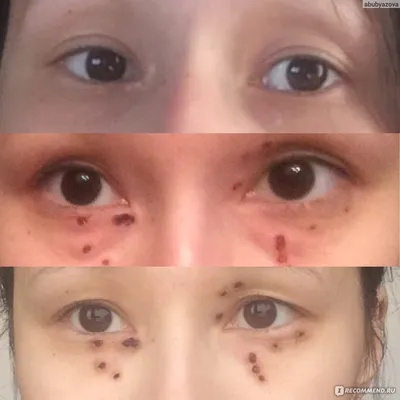 Глаза - нужен совет медиков! | Пикабу