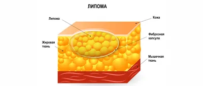 Свежий взгляд.