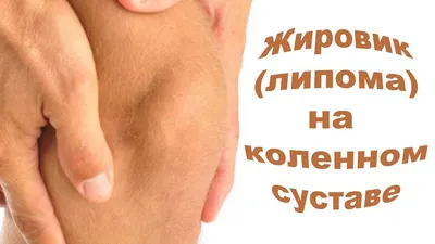 Удаление липом в Москве, цены на удаление жировиков в сети клиник  «Ниармедик»
