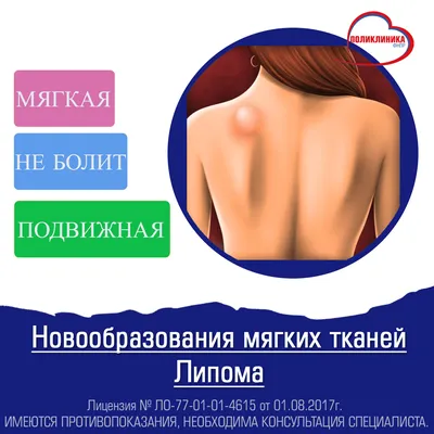 Шишка на спине: основные причины, связь с болями и особенности образований  под кожей