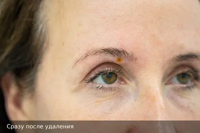 Почему у людей желтые глаза? | Анабио | Дзен